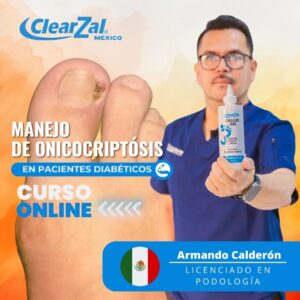 Manejo de la Onicocriptosis en pacientes Diabéticos / Lic. Armando Calderón