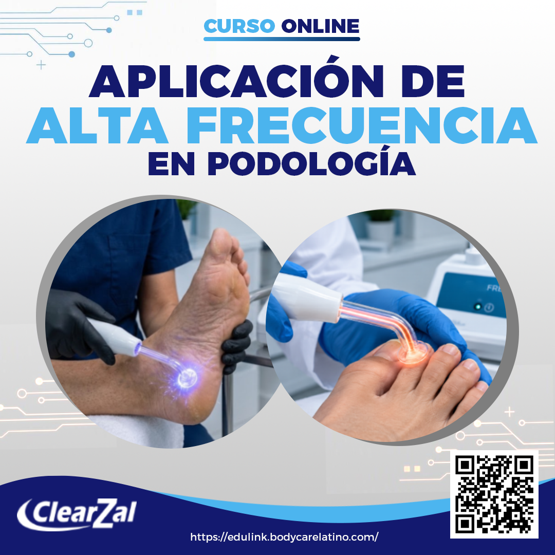 Aplicación de Alta Frecuencia en Podología
