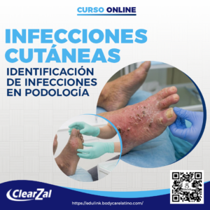 Infecciones Cutáneas