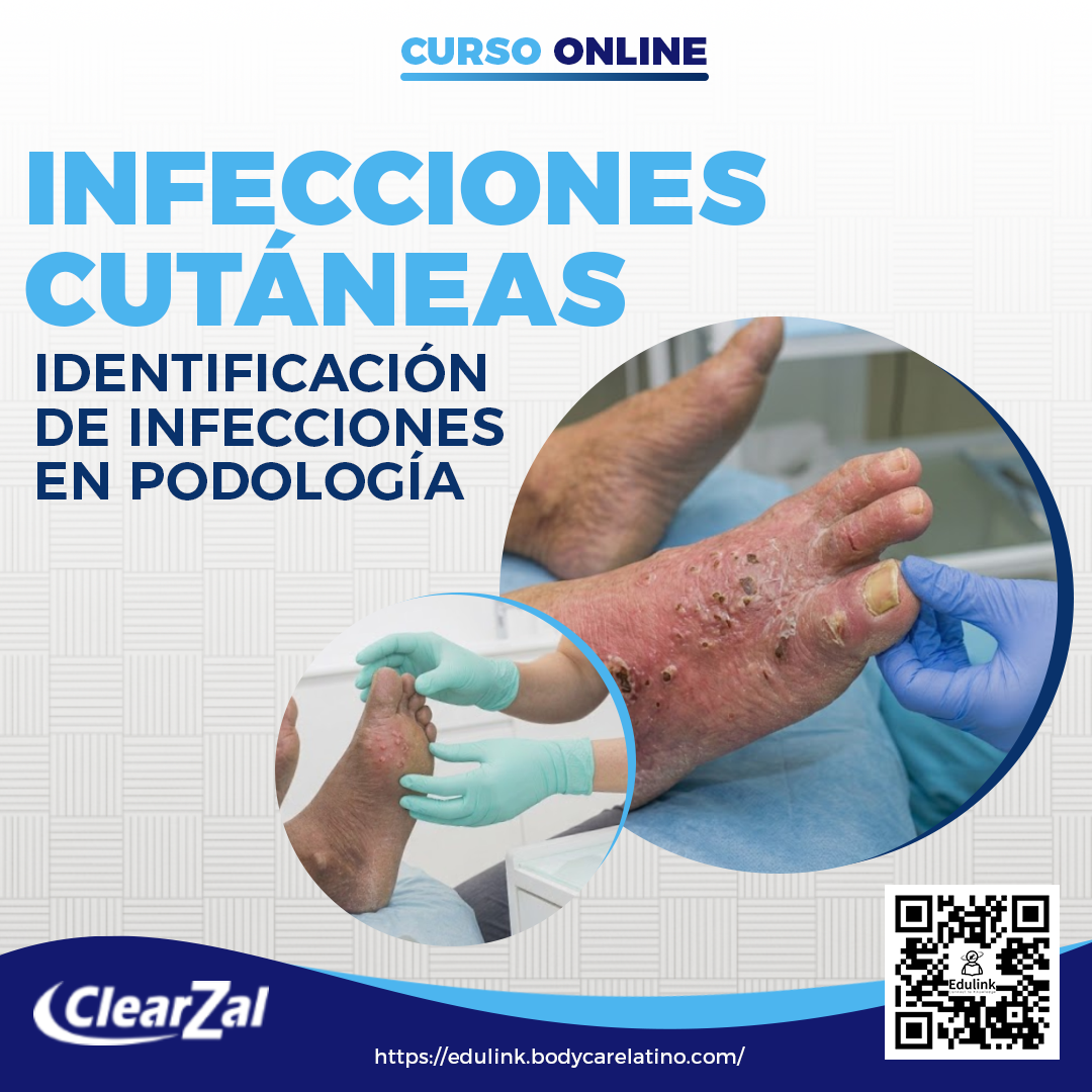 Infecciones Cutáneas