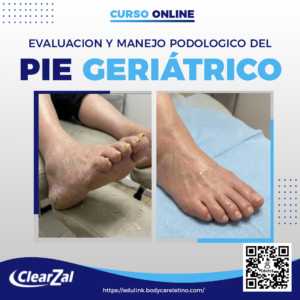 Evaluación y Manejo del Pie Geriátrico