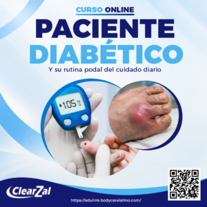 Paciente diabético y su rutina podal de cuidado diario