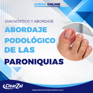 ABORDAJE PODOLÓGICO DE LAS PARONIQUIAS