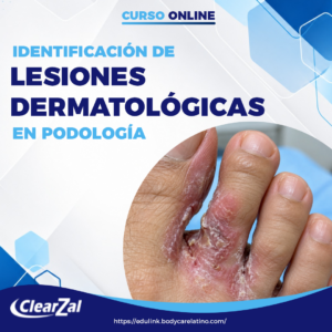 IDENTIFICACIÓN DE LESIONES DERMATOLÓGICAS EN PODOLOGÍ